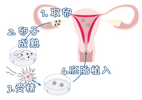 培养箱